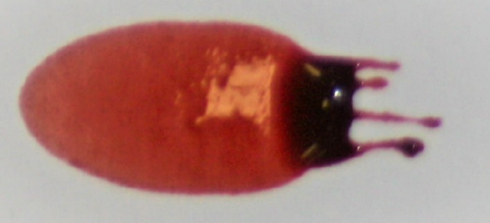 this stain is rounder than the one in the previous image